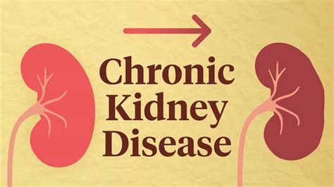 chronic kidney disease near occidental|Chronic kidney disease .